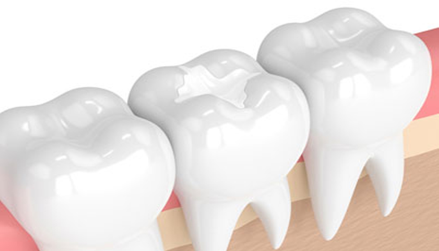 Odontoiatria conservativa